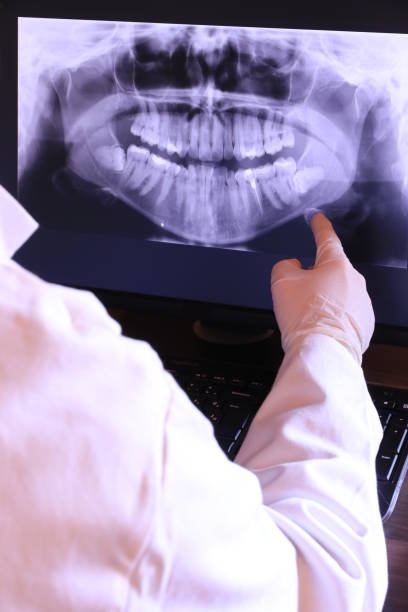 Best Emergency Dental Care for Broken or Chipped Teeth in Sturgeon Bay, WI