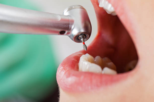 Best Emergency Denture Repair in Sturgeon Bay, WI